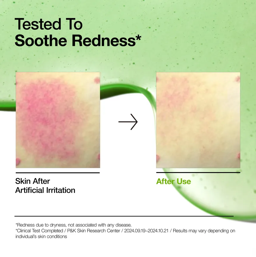 Anua Azelaic Acid 10 Hyaluron Redness Soothing Serum My Korean Beauty