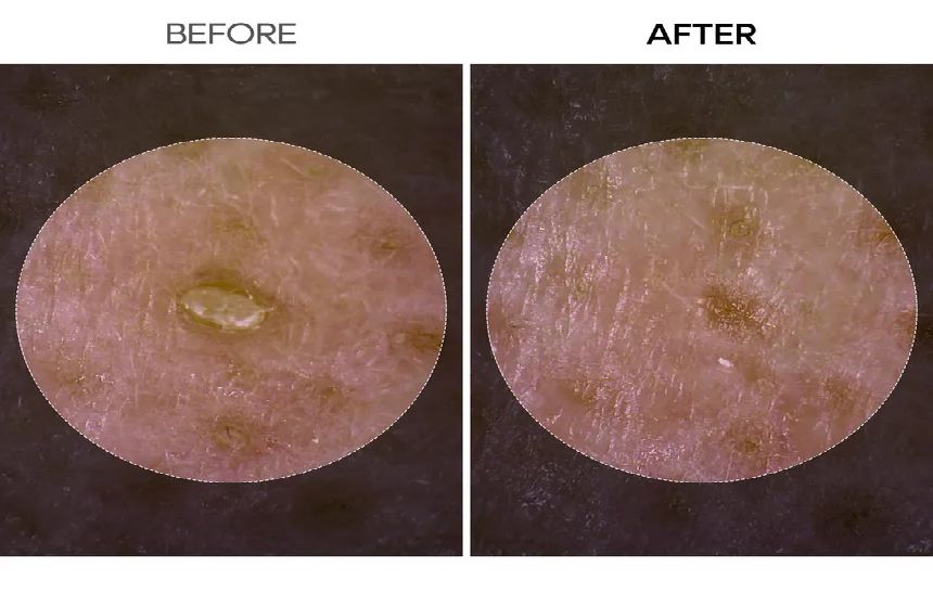 Dr.Melaxin Peel Shot Exfoliant Rice Ampoule