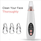 Instrument Cosmétique pour Nettoyer les Pores et Éliminer les Points Noirs - Korean Beauty & Healthy