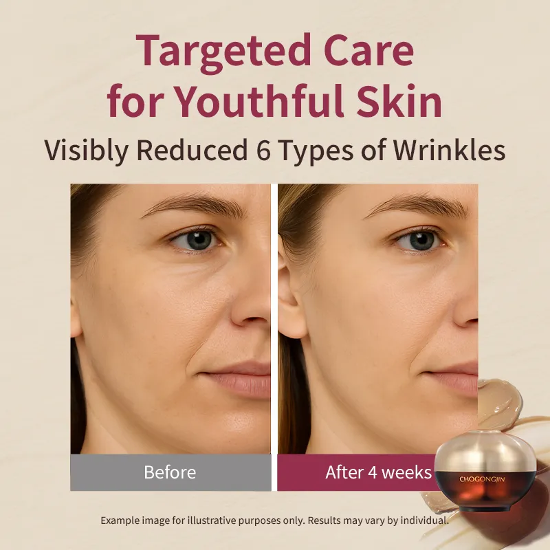 MISSHA - Chogongjin Youngan Lifting Set