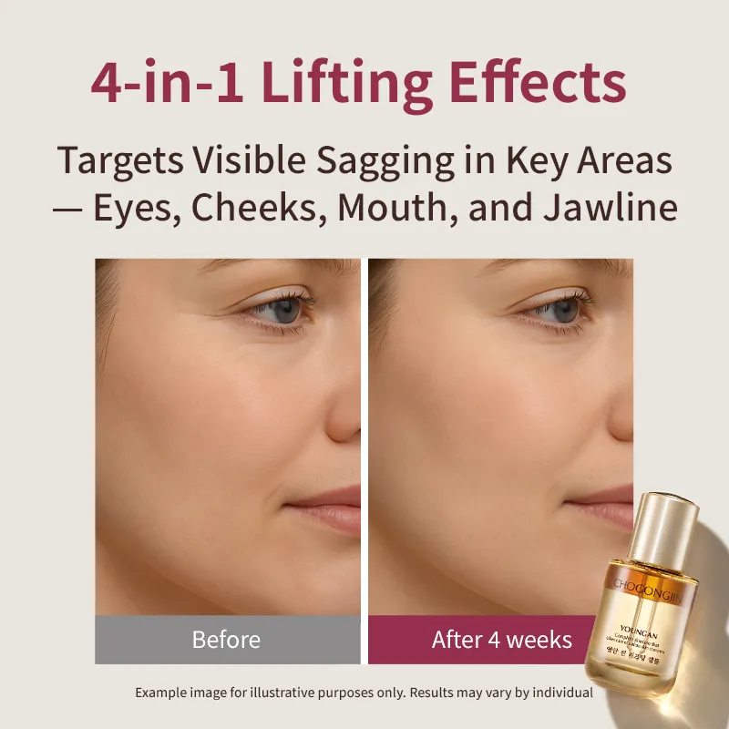 MISSHA - Chogongjin Youngan Lifting Set