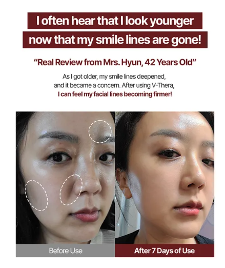 رعاية الأم - EMS V-THERA الإصدار الوردي