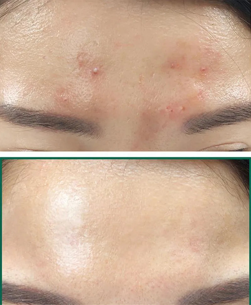 Some By Mi -Toner Miracle - AHA BHA PHA - My Korean Beauty 