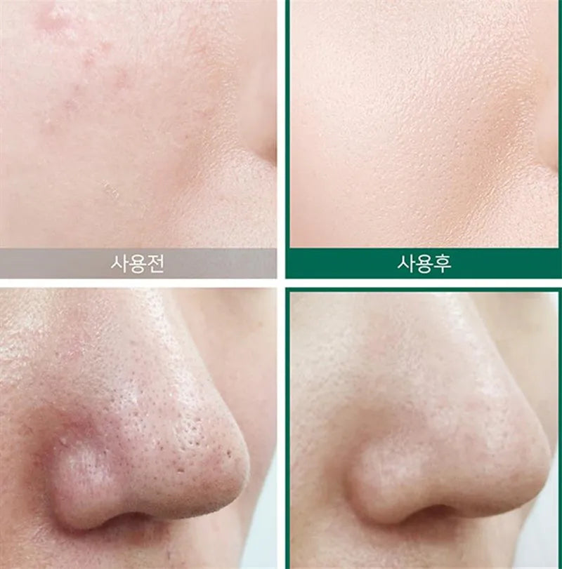 Some By Mi -Toner Miracle - AHA BHA PHA - My Korean Beauty 